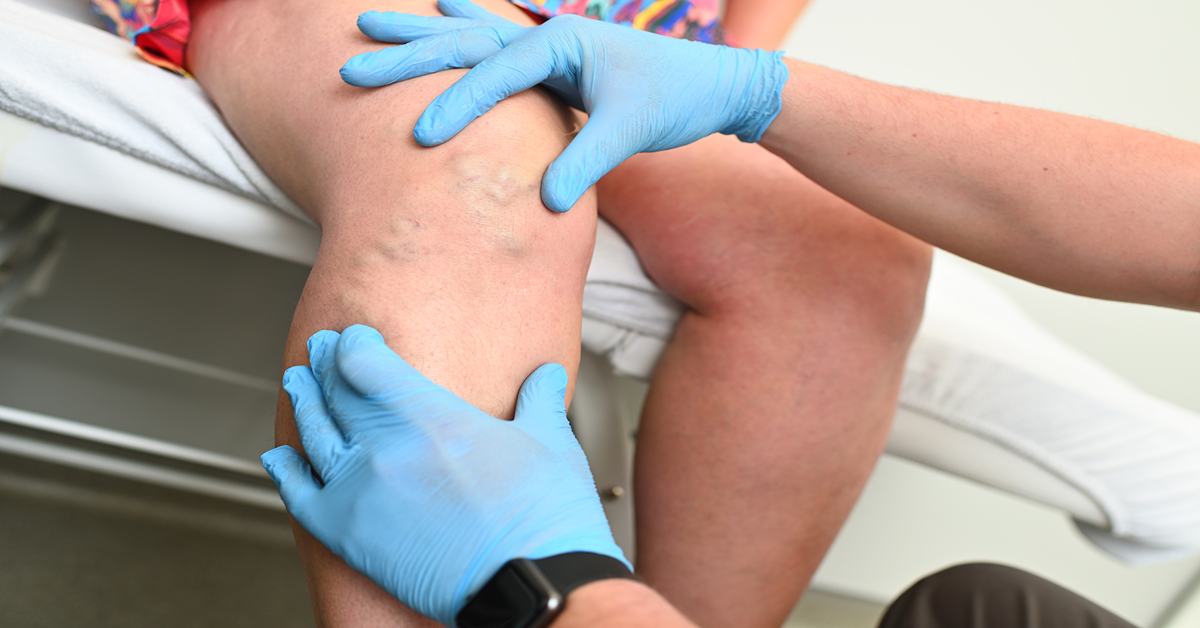 hlebologist-examines-a-patient-with-varicose-veins